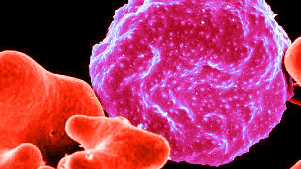 A red blood cell infected by malaria (Credit: Alamy)
