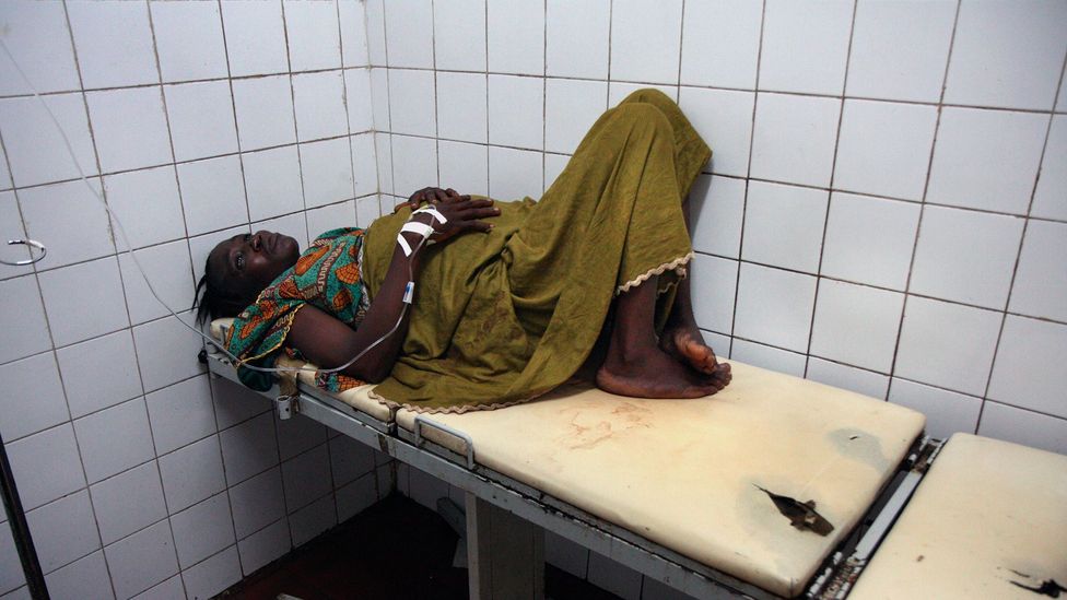 In Sierra Leone, which has the world's highest maternal mortality rate, Kamara has had an emergency C-section; she survived but her baby was stillborn (Credit: Getty Images) In Sierra Leone, which has the world's highest maternal mortality rate, Kamara has had an emergency C-section; she survived but her baby was stillborn (Credit: Getty Images)