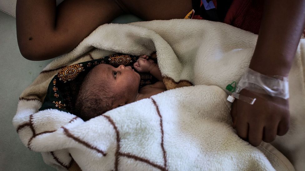 ‘A C-section is just a second way of delivering’ (Credit: Getty Images) ‘A C-section is just a second way of delivering’ (Credit: Getty Images)