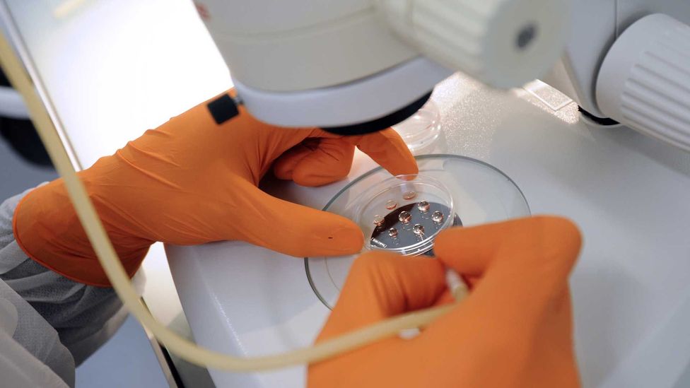 Stem cell treatment for multiple sclerosis is available in the UK on the NHS, but eligibility is limited (Credit: Getty Images) Stem cell treatment for multiple sclerosis is available in the UK on the NHS, but eligibility is limited (Credit: Getty Images)
