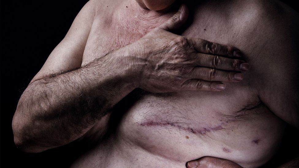 Why Breast Cancer Genes Need To Be Rebranded Bbc Future