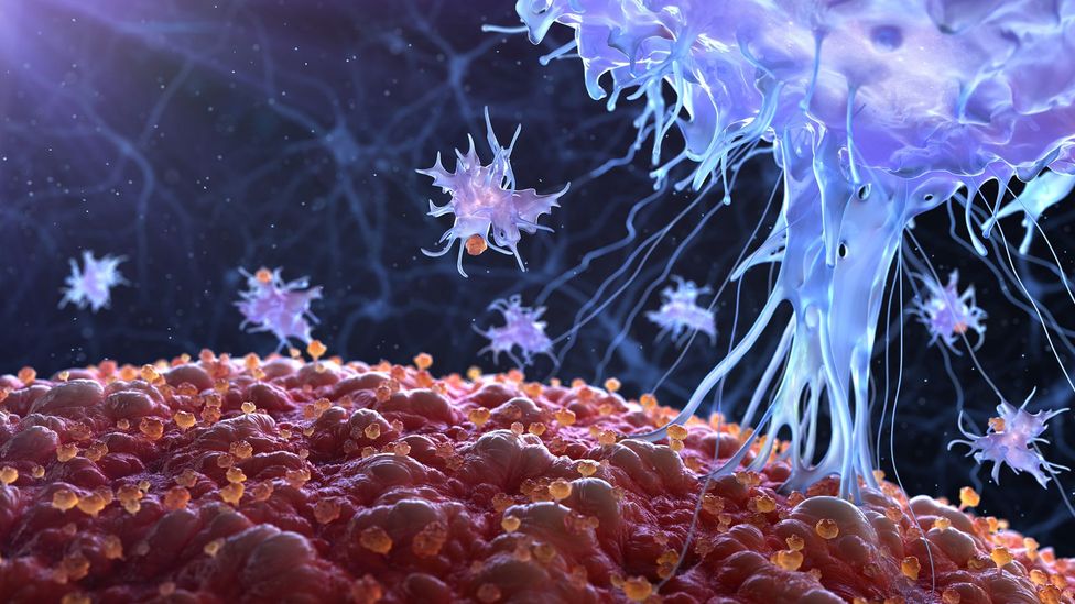 When the cytokines alerting the immune system become too abundant, the reaction may not be able to stop itself (Credit: Getty Images)