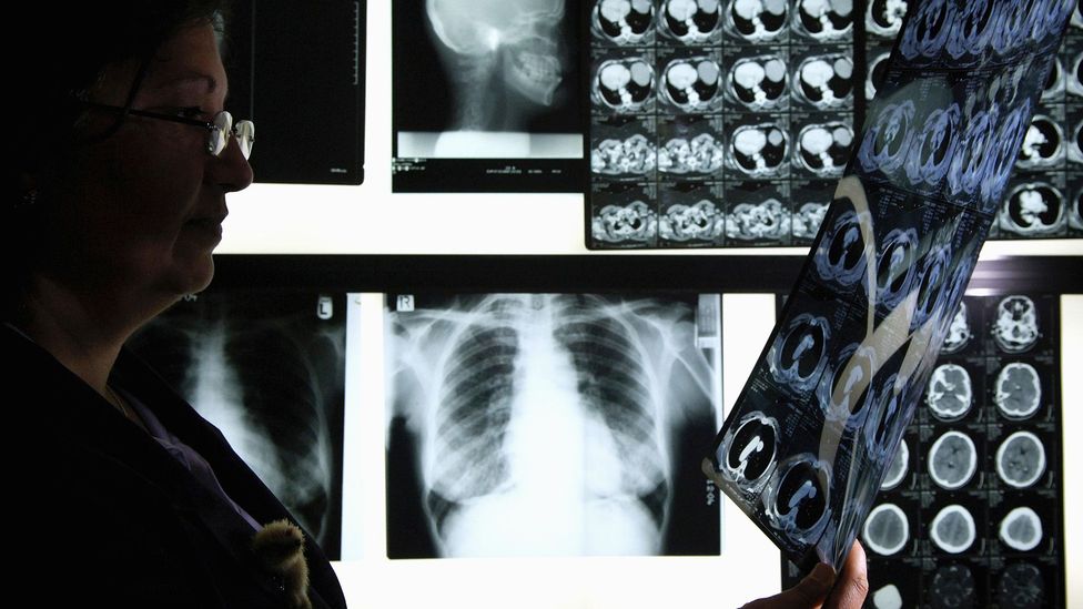 ‘Swarm intelligence’ can help radiologists reduce errors by a third when diagnosing pneumonia (Credit: Getty Images) ‘Swarm intelligence’ can help radiologists reduce errors by a third when diagnosing pneumonia (Credit: Getty Images)