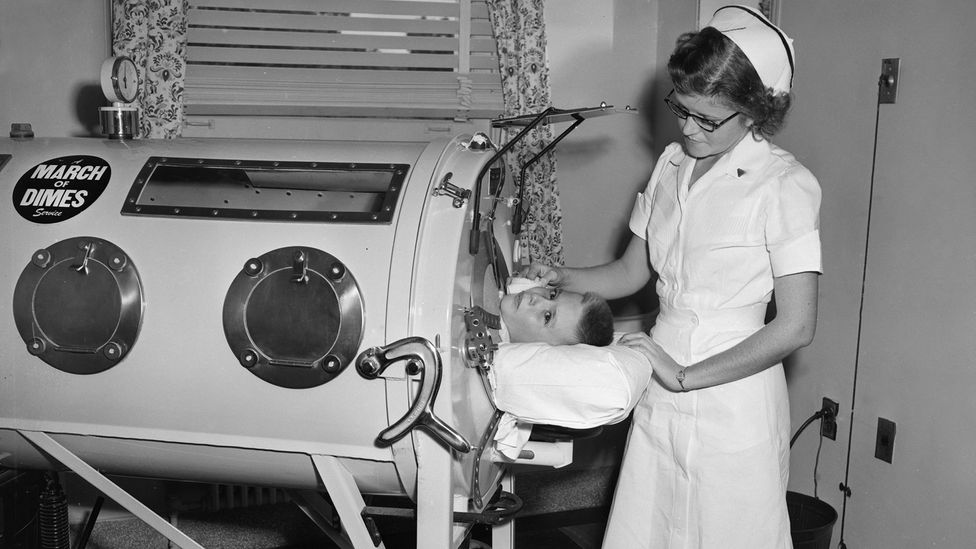 Polio patients had to endure long and uncomfortable treatment in iron lung machines before the advent of portable ventilators (Credit: Getty Images)