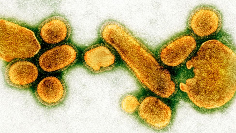 1918 flu virus (Credit: Science Photo Library)