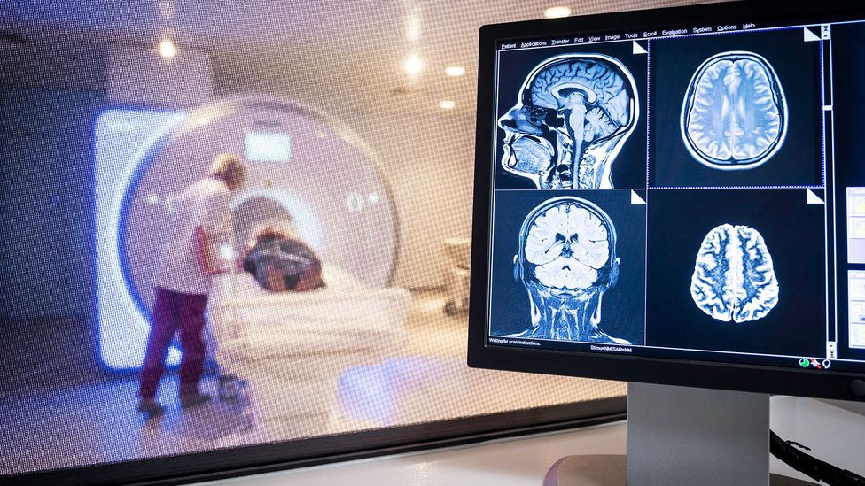 Radiology staff attend a patient being scanned to produce a MRI of their brain (Credit: Science Photo Library)