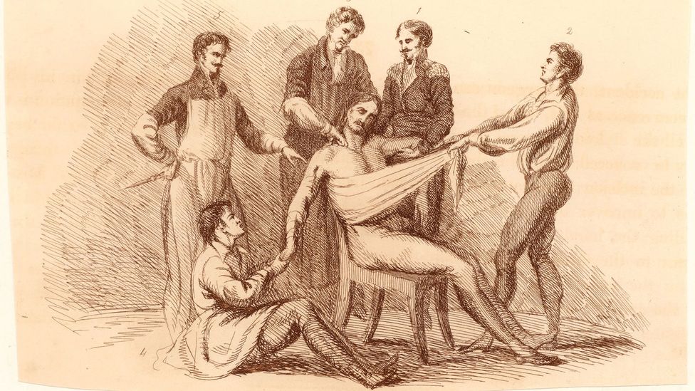 Without anaesthesia, patients had to be held down as they were subjected to agonising pain (Credit: Getty Images) Without anaesthesia, patients had to be held down as they were subjected to agonising pain (Credit: Getty Images)