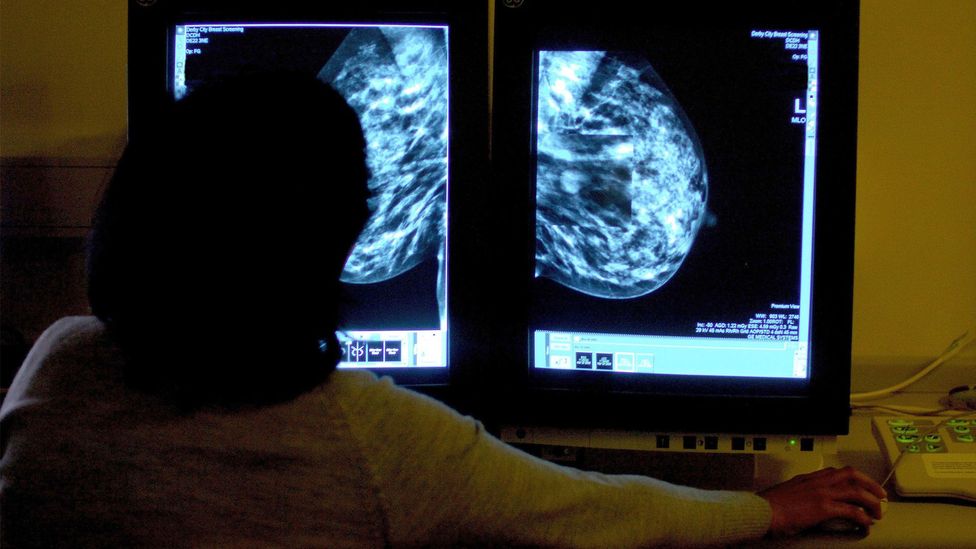 Due to the way cancer screening is offered, transgender men will often miss out on vital tests that can detect the signs of breast cancer (Credit: Press Association)