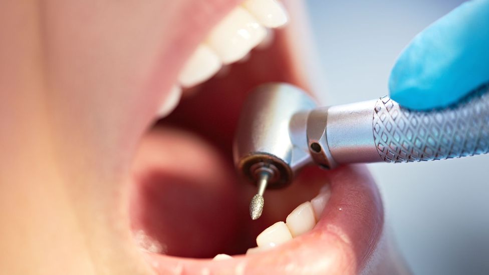 Many of us fear a visit to the dentists, but the moments of pain are often only fleeting (Credit: Getty Images)