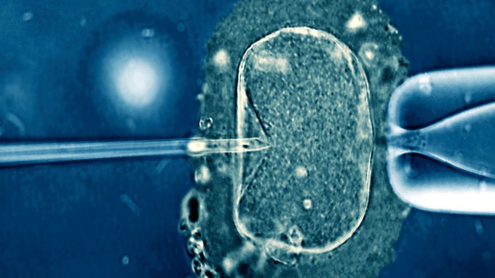 Scientists are developing new techniques to identify the best eggs for use in IVF treatments (Credit: Science Photo Library)