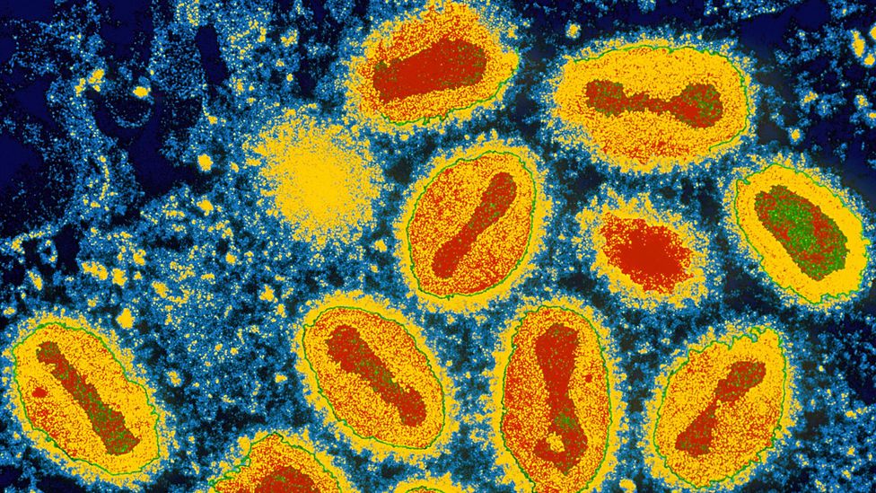 Smallpox has plagued humans for thousands of years but was eradicated after a sustained vaccination campaign (Credit: Science Photo Library)
