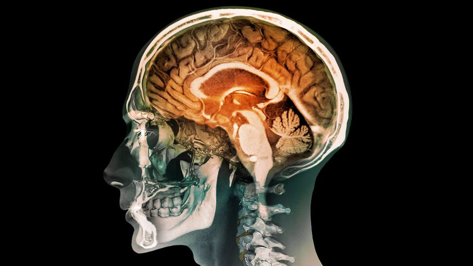 The corpus callosum – the orange arch beneath the folded cerebrum – facilitates communication between the hemispheres of the brain (Credit: Science Photo Library) The corpus callosum – the orange arch beneath the folded cerebrum – facilitates communication between the hemispheres of the brain (Credit: Science Photo Library)