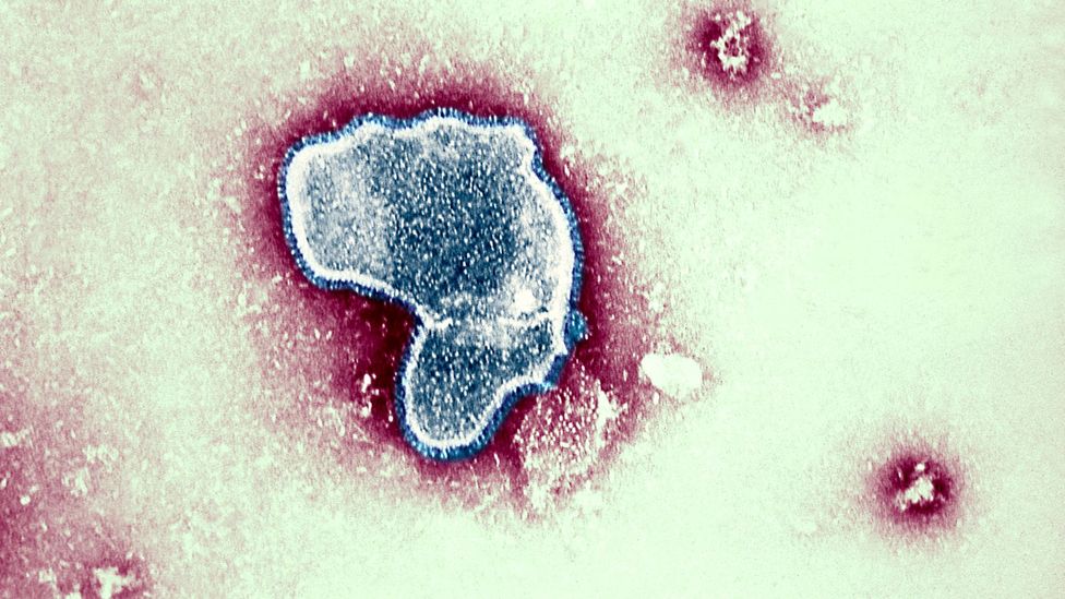 The respiratory syncytial virus (RSV) is a common single-RNA stranded virus that causes infected cells to fuse together (Credit: BSIP/UIG/Getty Images)