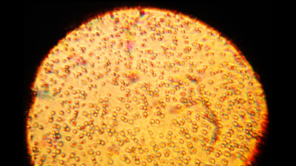 A microscopy image of a sample of human breast milk (Credit: Wikimedia Commons)