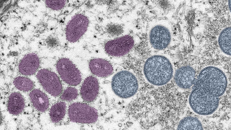 The mature monkeypox virus – shown on the left in his image – is a brick-shaped envelope of genetic material, an oily membrane and proteins (Credit: Smith Collection/Getty Images)