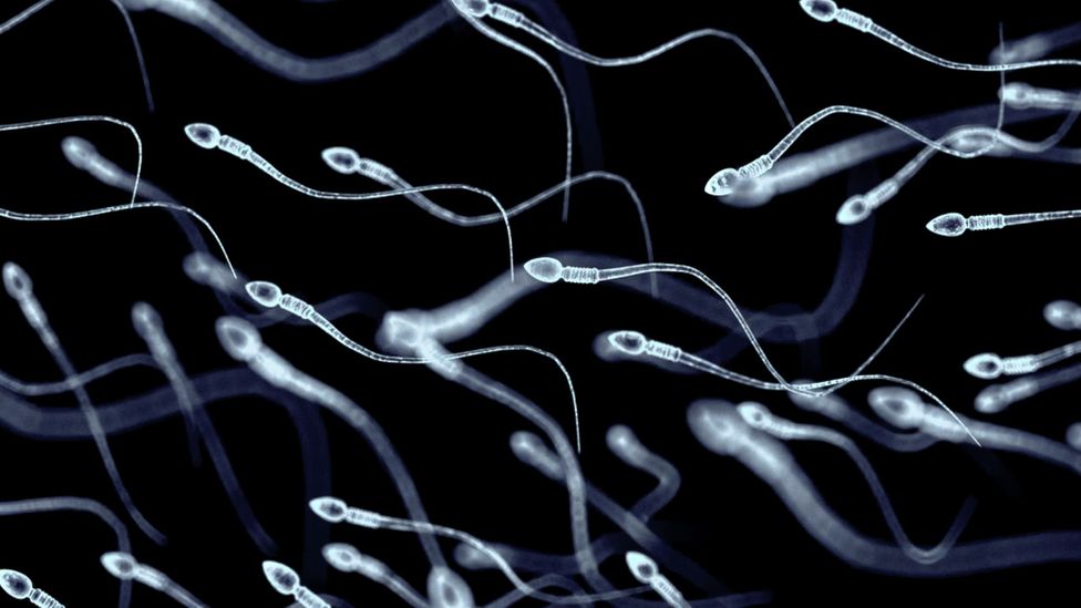 An illustration of sperm under the microscope (Credit: Getty Images)