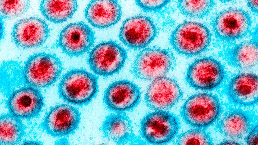 There are four known retroviruses that infect humans, including HIV-1 – viruses like this have helped to shape our evolution (Credit: Getty Images)
