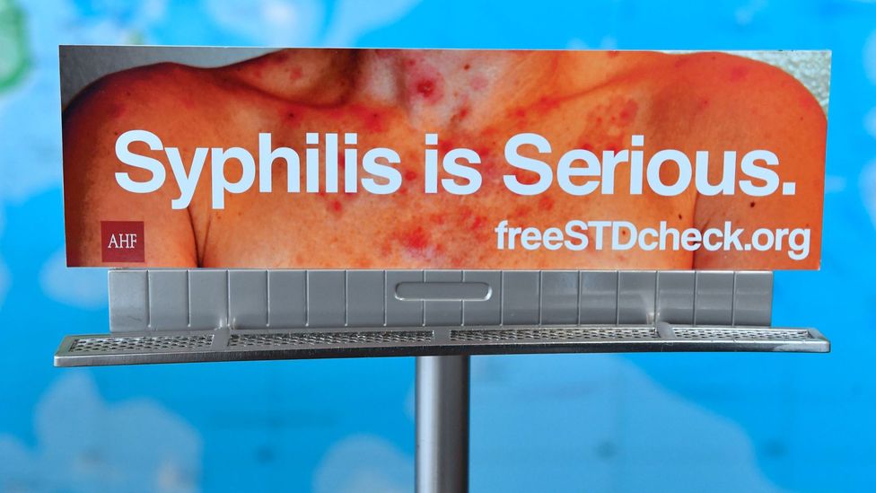 Model of a billboard used in Los Angeles reading: "Syphilis is serious" (Credit: Getty Images)