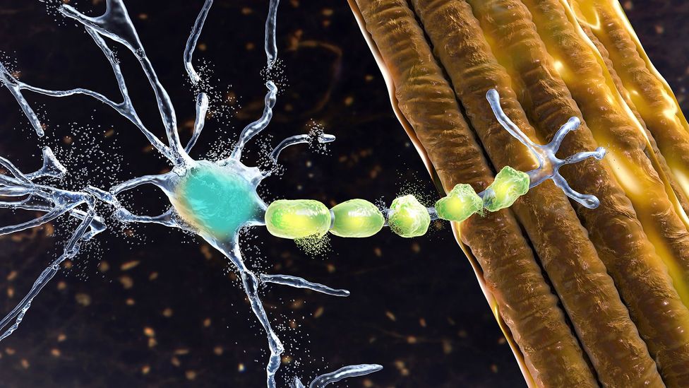 ALS affects the nerve cells that control voluntary muscle movement, known as motor neurones (Credit: Getty Images)