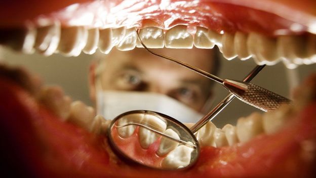 Teeth Veneers Woden