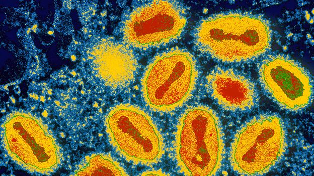 The deadly viruses that vanished without trace - BBC Future
