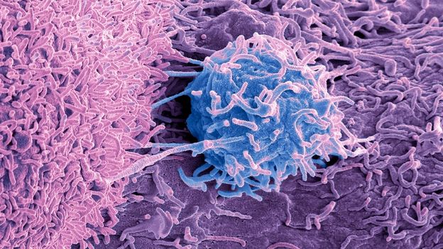 Tajomstvo mikróbov žijúcich vo vnútri nádorov