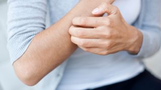 Person scratching arm (Credit: Getty Images)